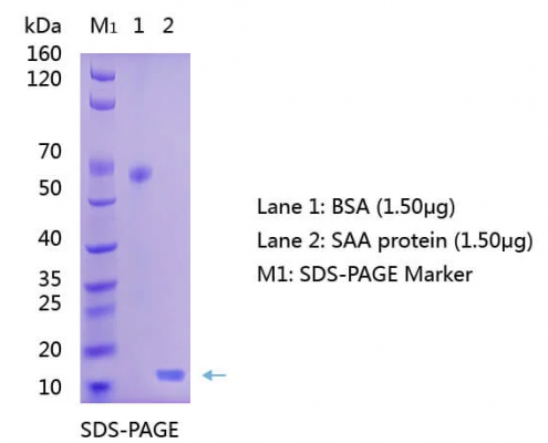 Anti-Serum-Amyloid-A-SAA-Antibody-WB